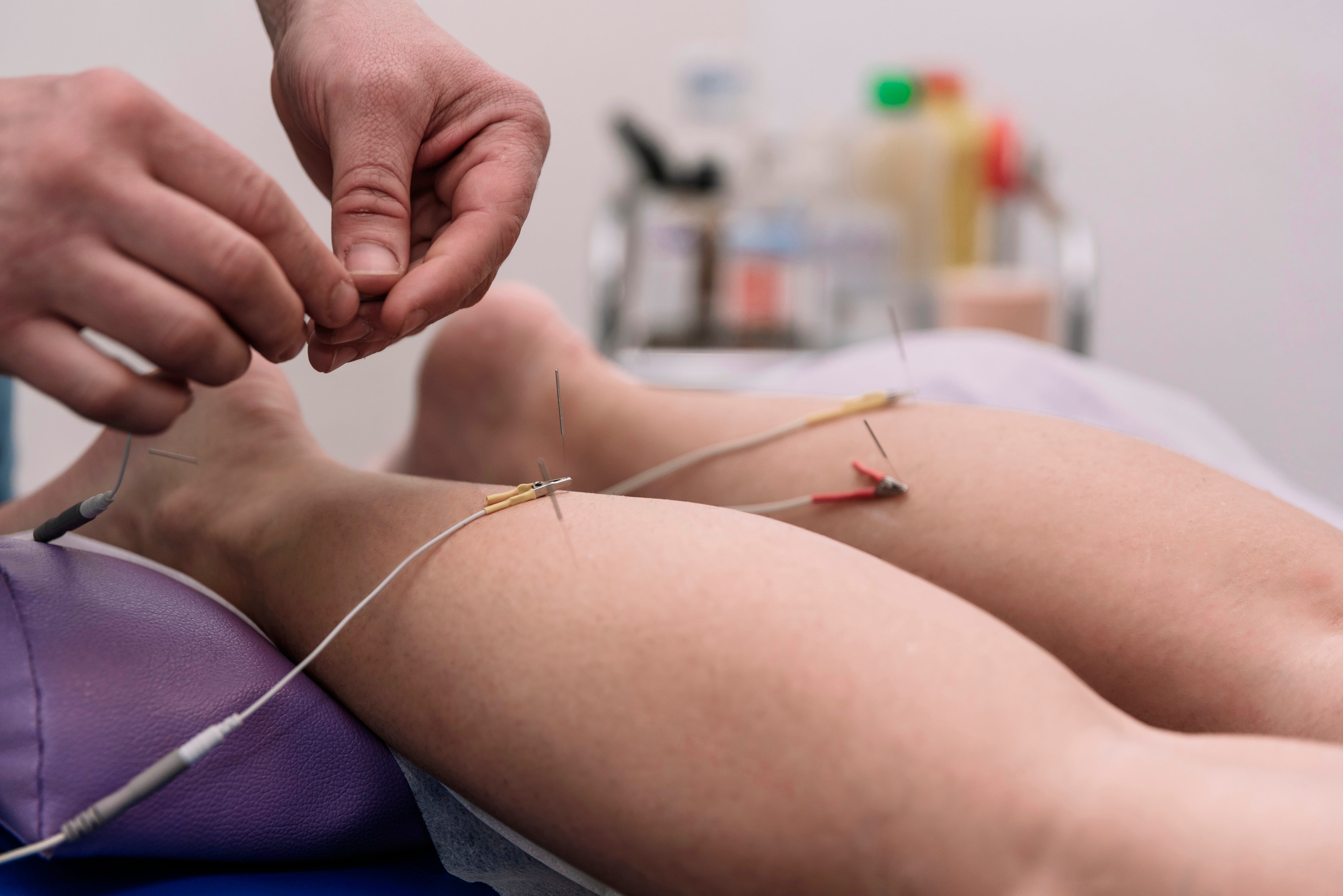 physical therapy for runners